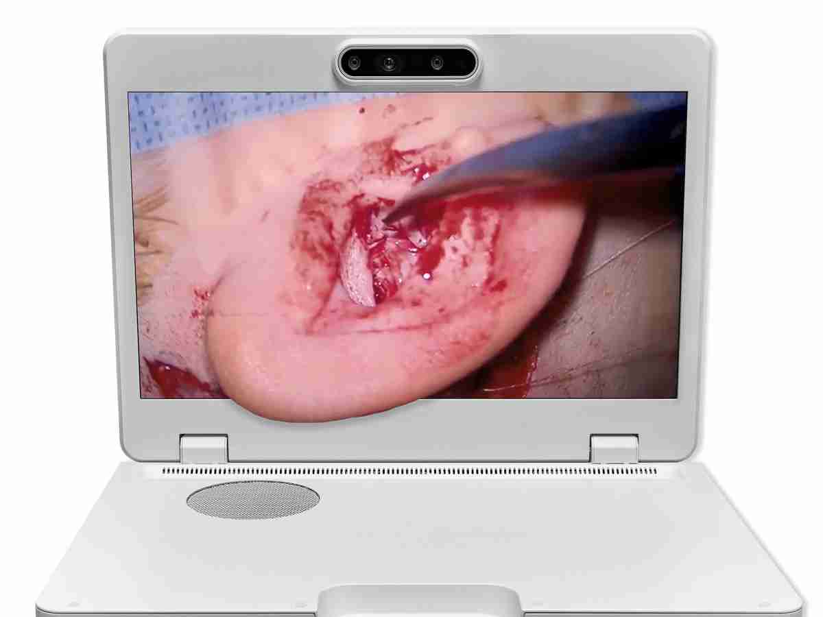 达擎之＂Heads-up 3D显微手术显示系统＂，，，整合4K裸眼3D显示及眼球追踪系统，，，，具备快速追踪人眼移动位置功能，，，，减轻医师长时间维持固定姿势的负担，，，，让医师能有更宽广清晰的3D立体视野及更舒适的姿势来执行手术。。。